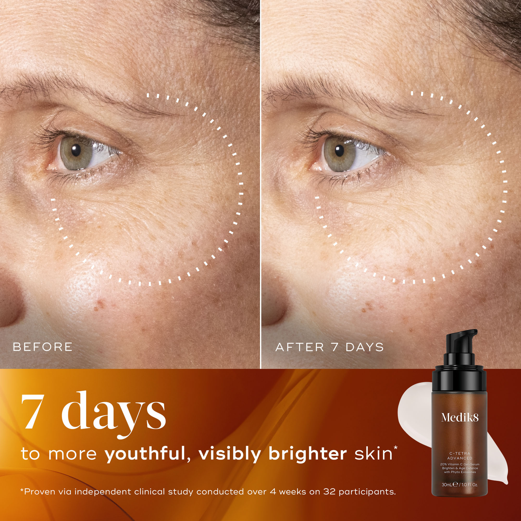Medik8 C-Tetra Advanced 30ml