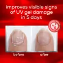 Essie To The Rescue Advanced Nail Treatment