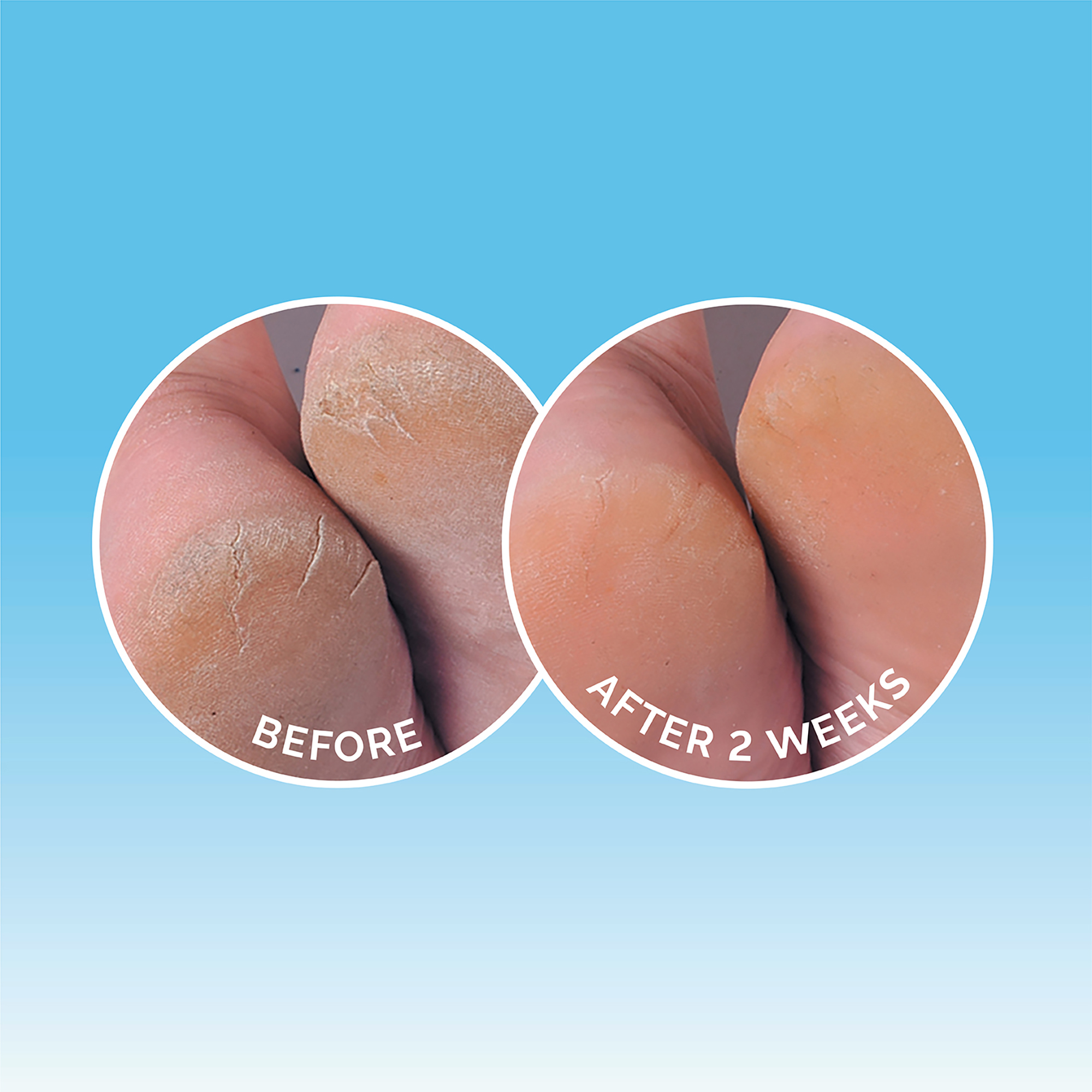 Dermal Therapy Heel Balm