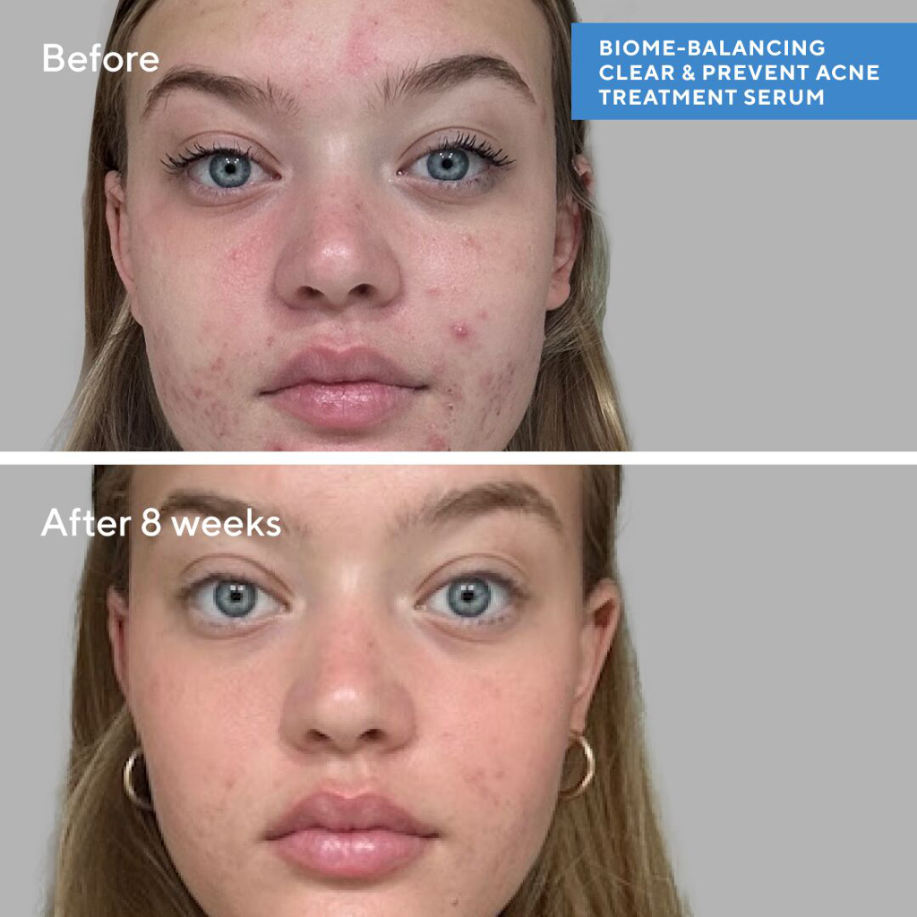 Murad Blemish Control Biome Balancing Clear & Prevent Serum