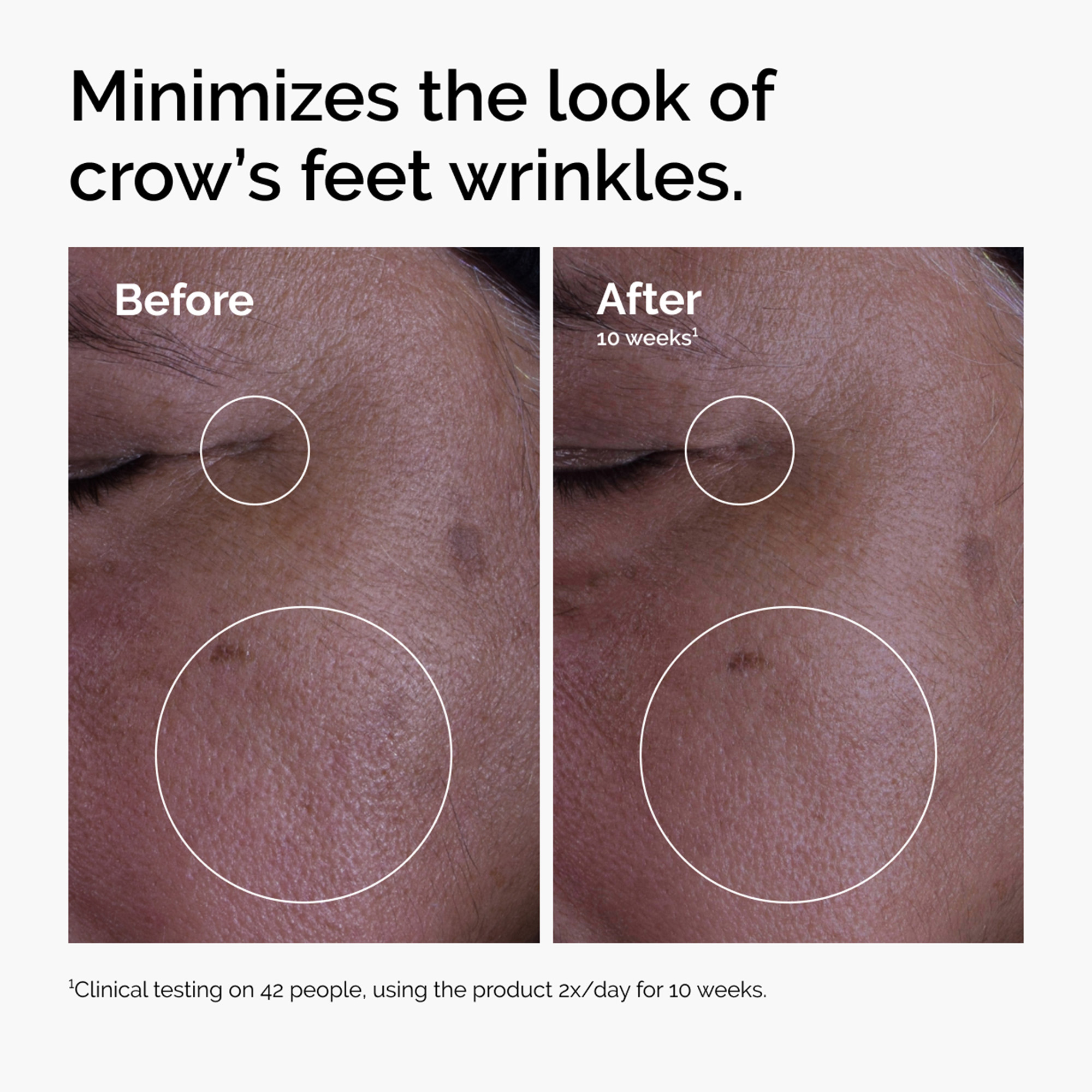 The Ordinary GF 15% Solution - 30ml