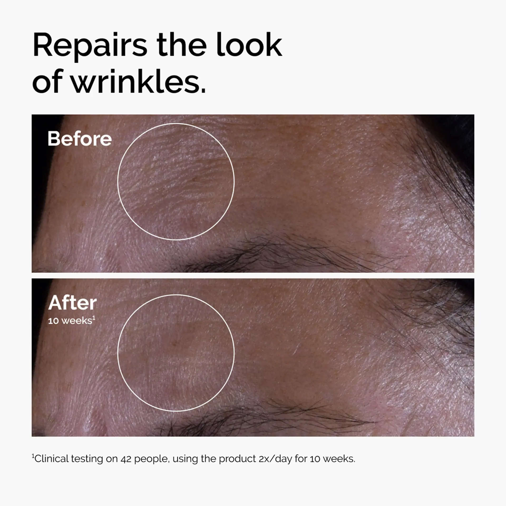 The Ordinary GF 15% Solution - 30ml