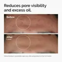 The Ordinary Niacinamide 10% + Zinc 1% - 30ml