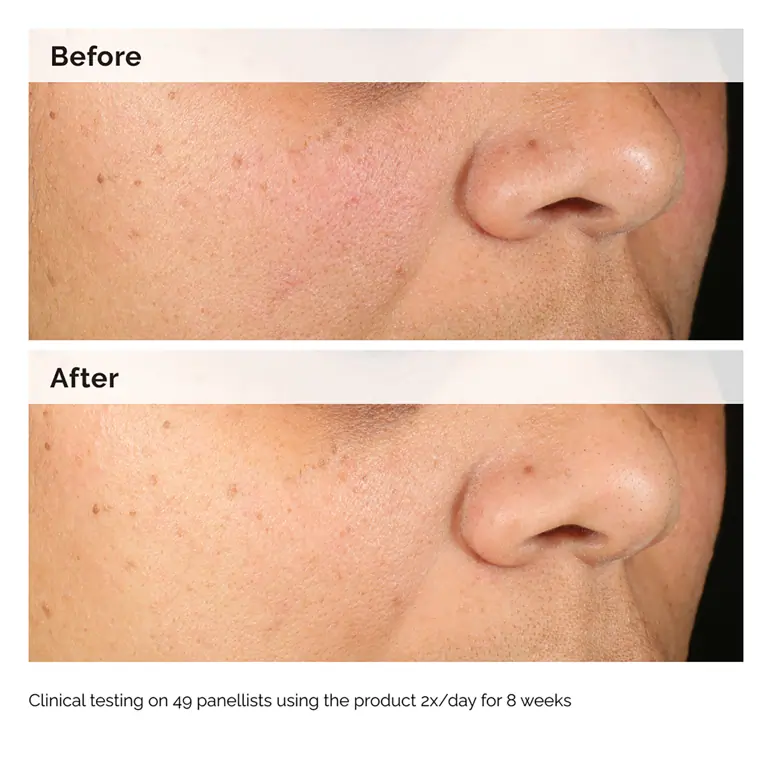The Ordinary Alpha Arbutin 2% + HA Serum 30ml