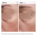 The Ordinary Niacinamide 5% Face and Body Emulsion - 100mL
