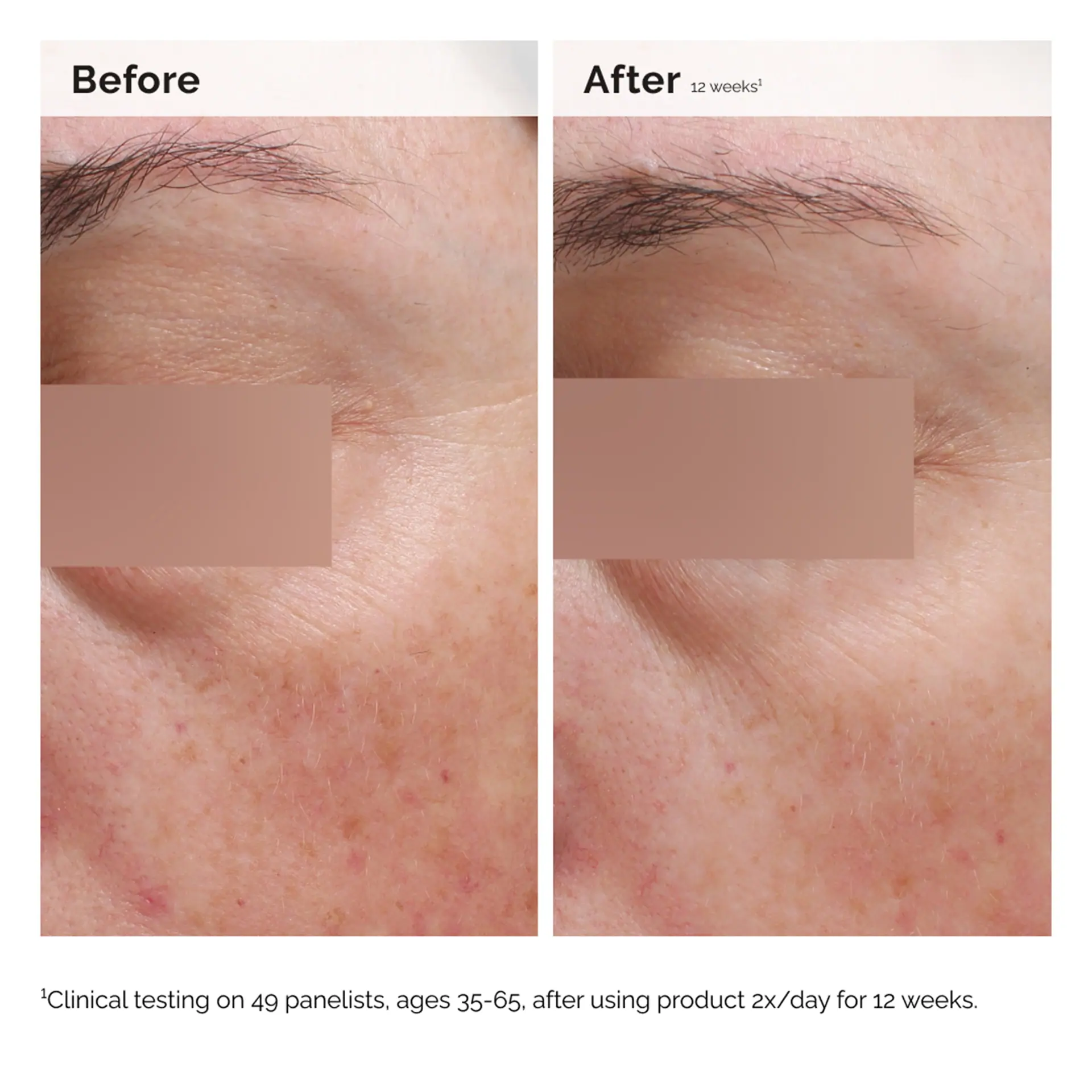 The Ordinary Niacinamide 5% Face and Body Emulsion - 100mL