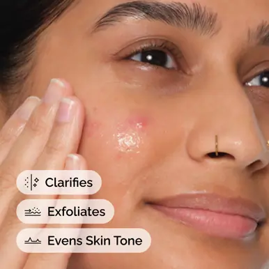 The Ordinary Salicylic Acid 2% Anhydrous Solution - 30ml