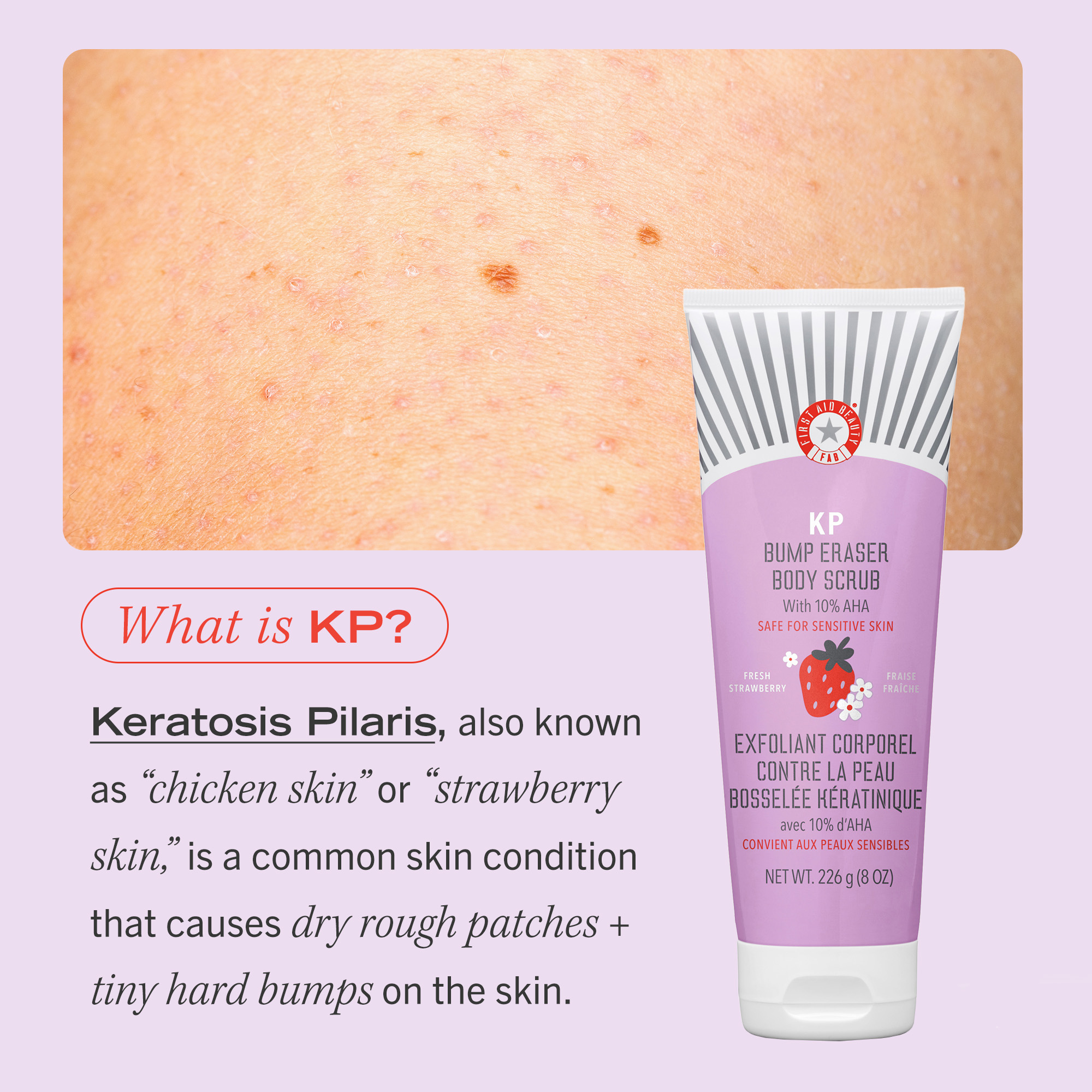 FIRST AID BEAUTY KP Bump Eraser with 10% AHA 226g - Strawberry