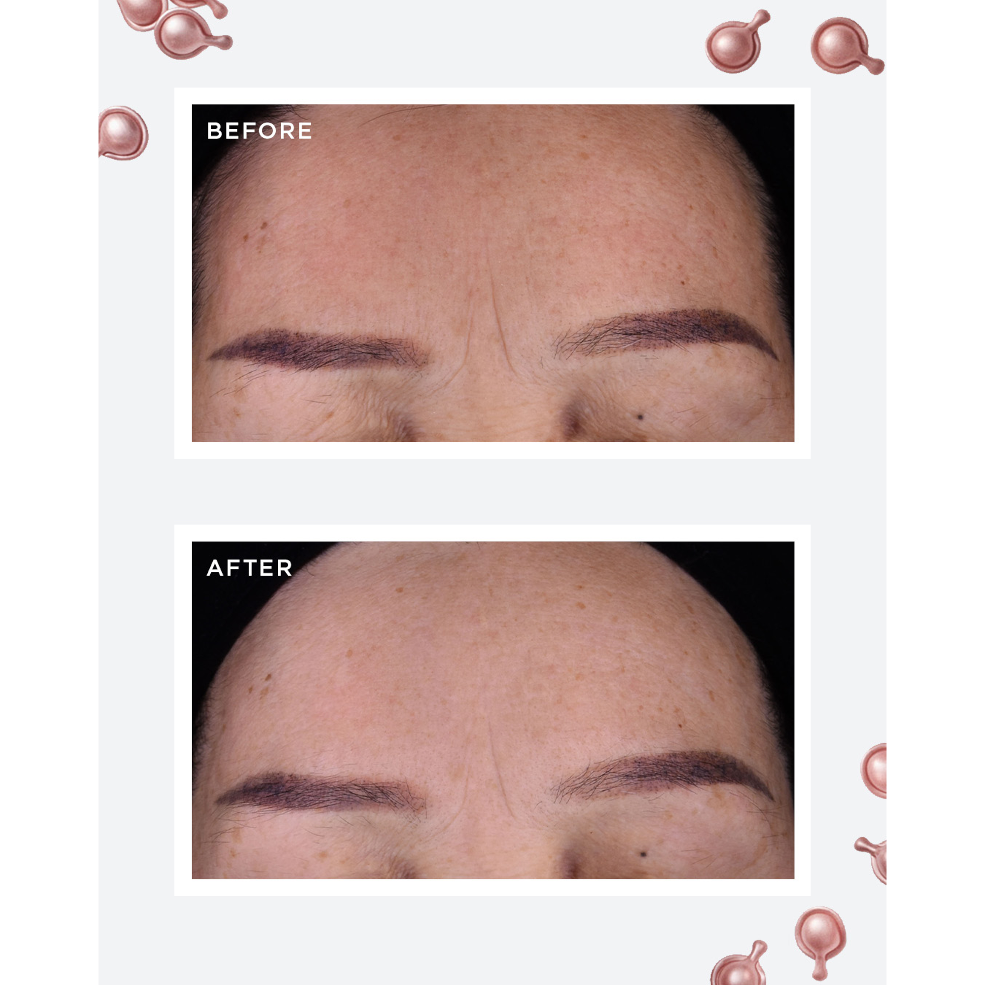 Elizabeth Arden Retinol + HPR Ceramide Capsules 60pcs