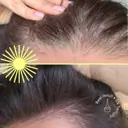 Done Ultimate Root Retouch Kit (5N Twilight - Darkest Brown)