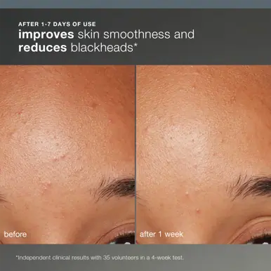 Dermalogica Daily Microfoliant Refill 74g