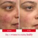 First Aid Beauty Ultra Repair Cream 177ml