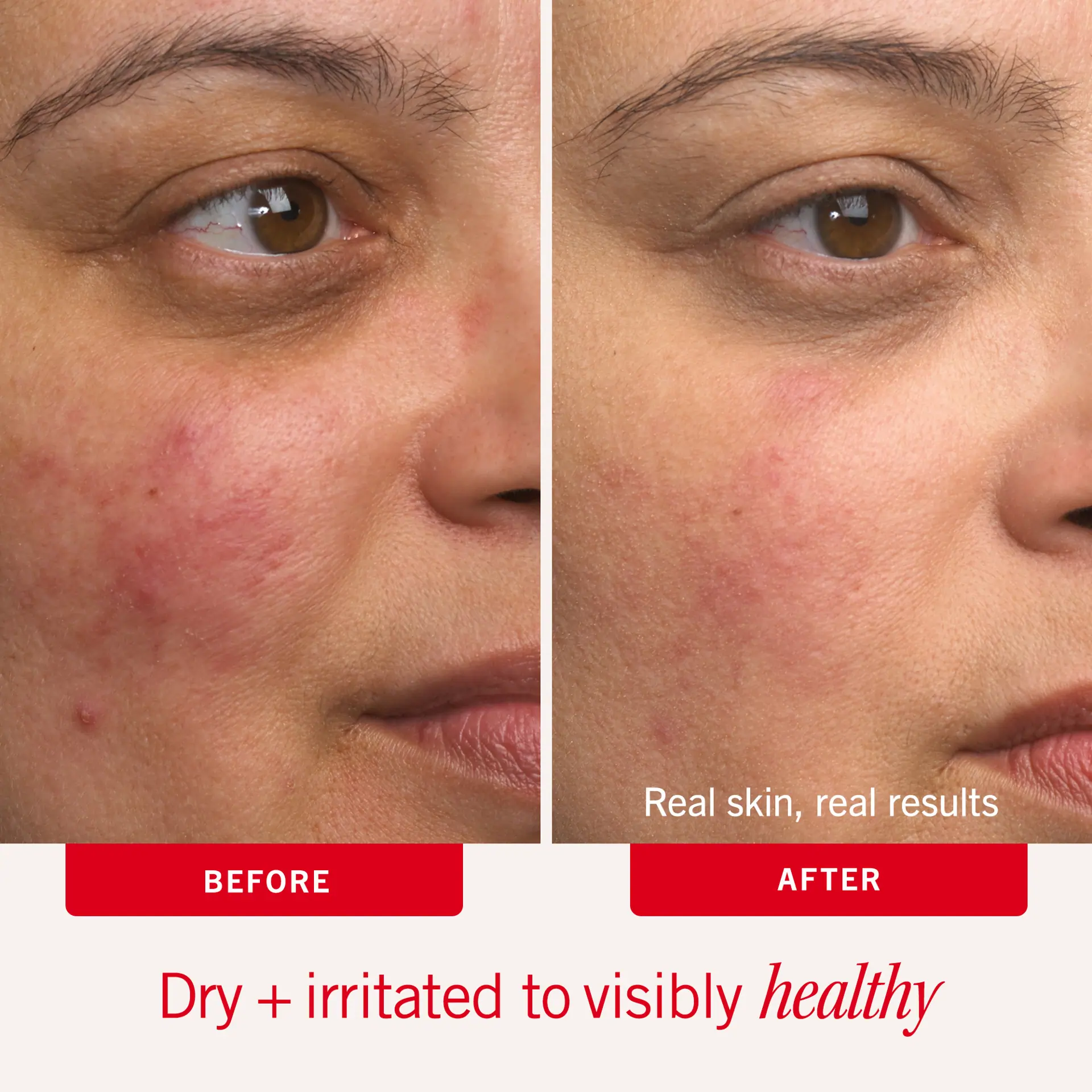 First Aid Beauty Ultra Repair Cream 237ml