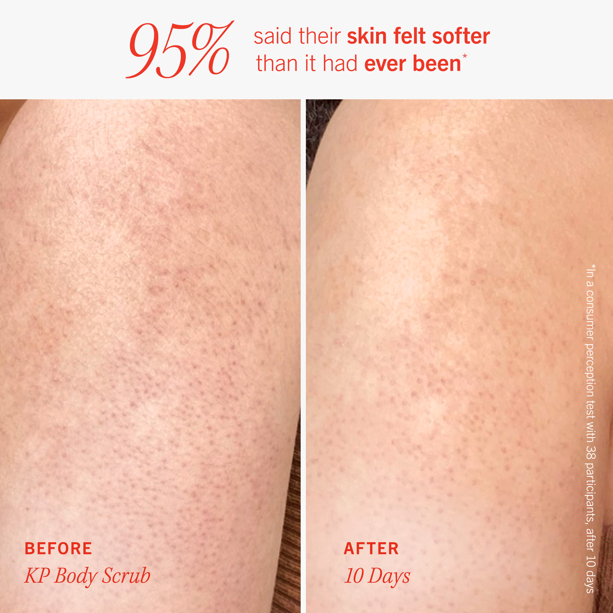 First Aid Beauty Soft + Smooth Starter Kit