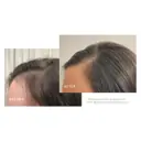 VIRTUE Flourish Hair Rejuvenation Treatment 1 Month
