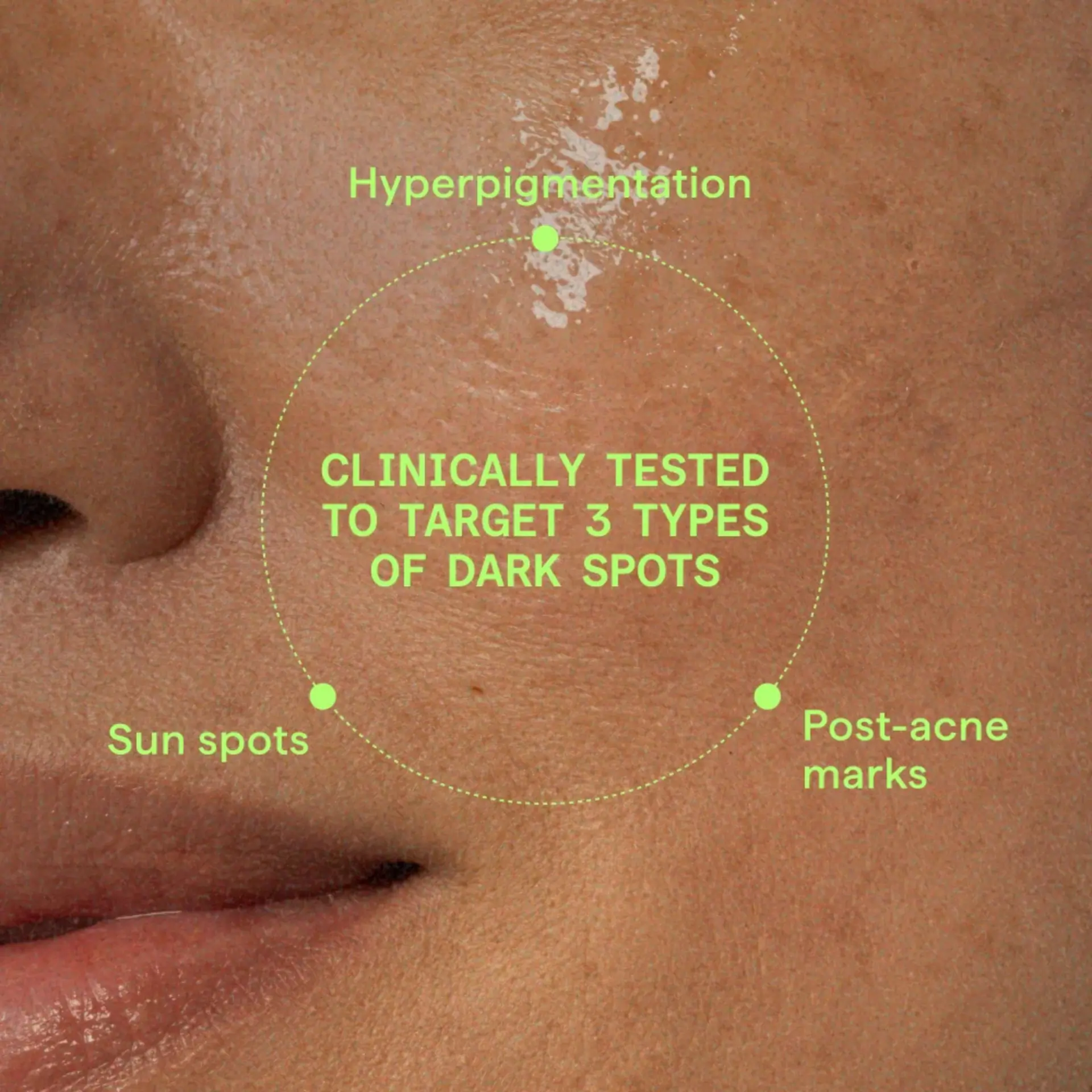 Murad Rapid Dark Spot Correcting Serum