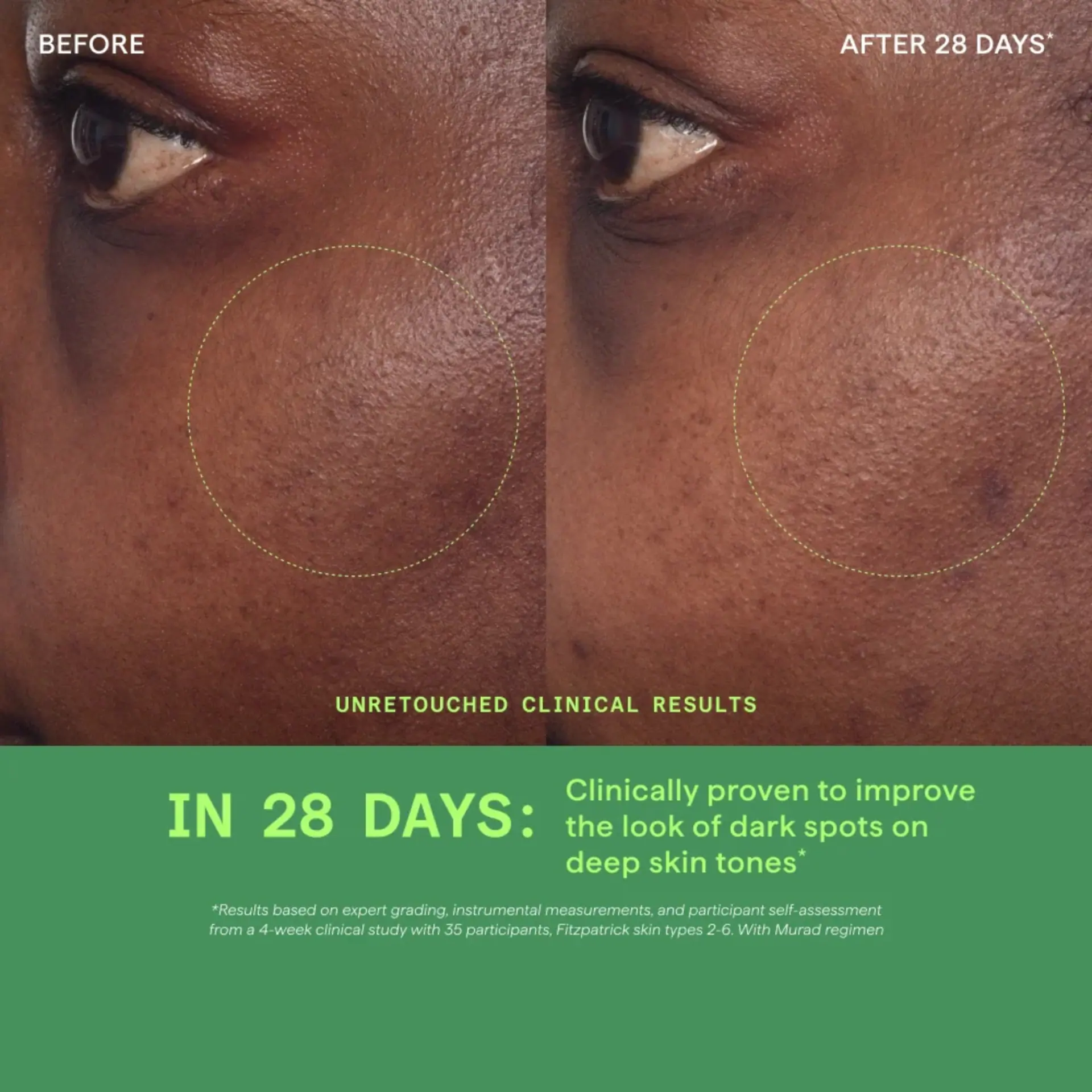 Murad Rapid Dark Spot Correcting Serum