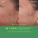 Murad Rapid Dark Spot Correcting Serum