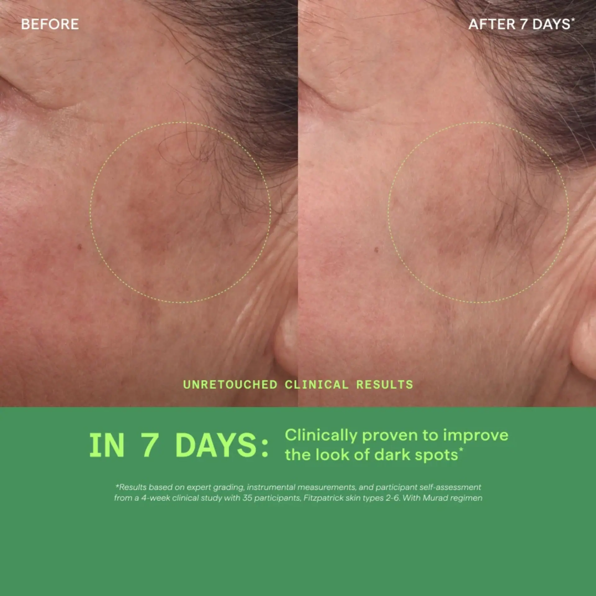 Murad Rapid Dark Spot Correcting Serum