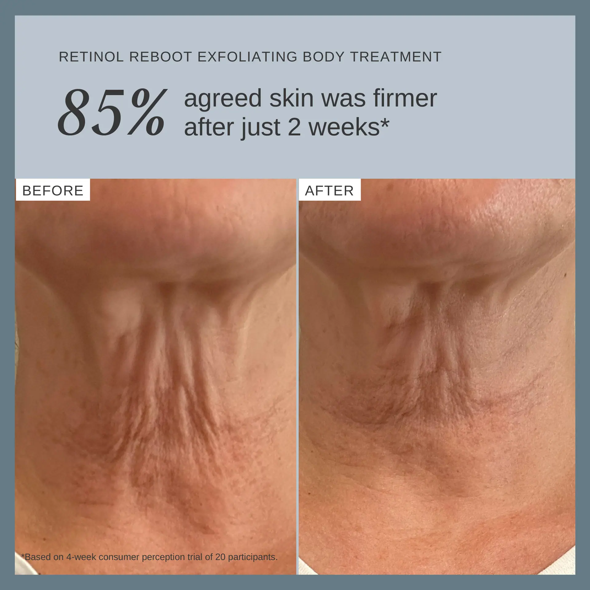 Alpha-H Retinol Reboot Exfoliating Body Treatment 120ml