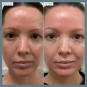 Alpha-H Vitamin B Serum with 5% Niacinamide 25ml