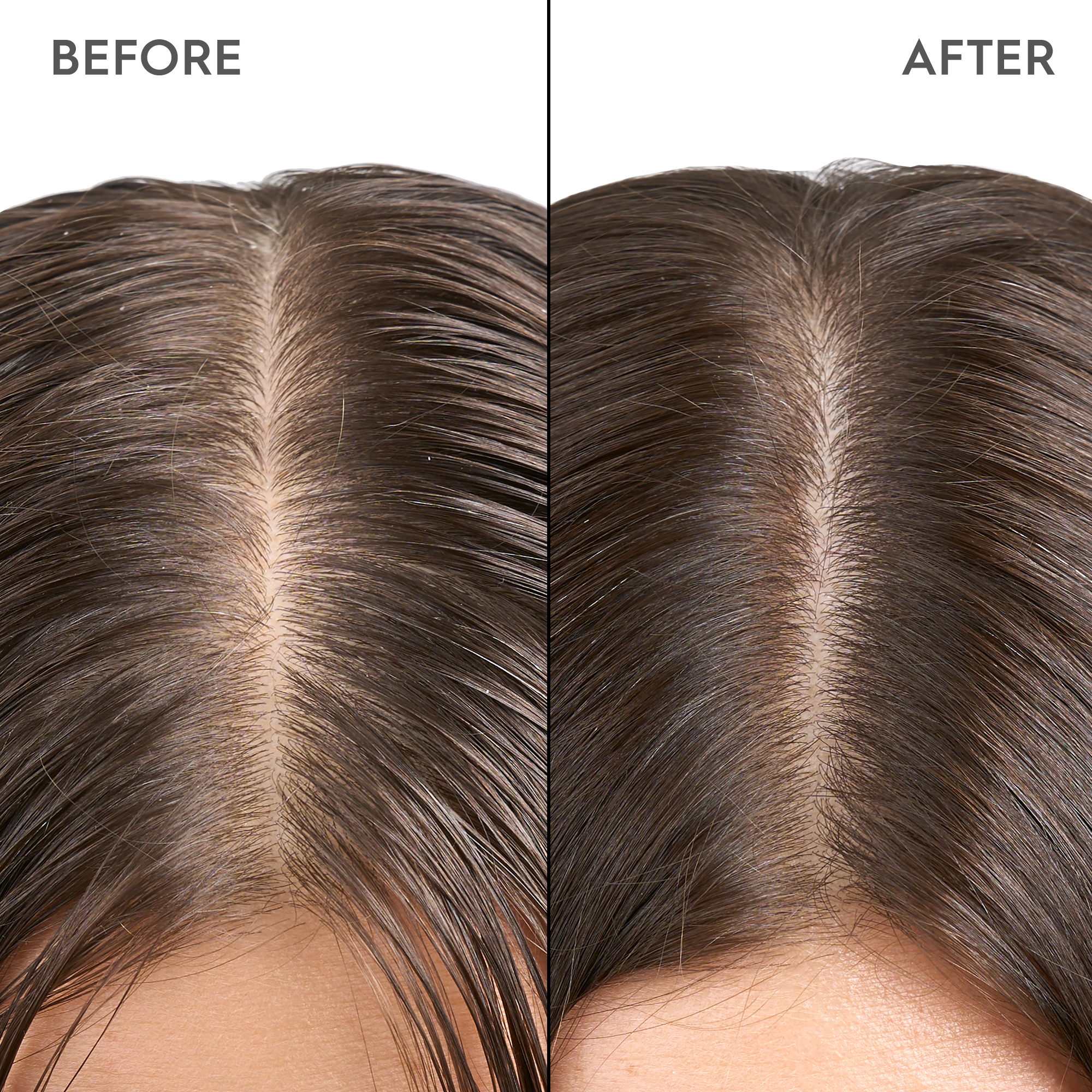 KERASILK Exfoliating Scalp & Hair Treatment 200ml