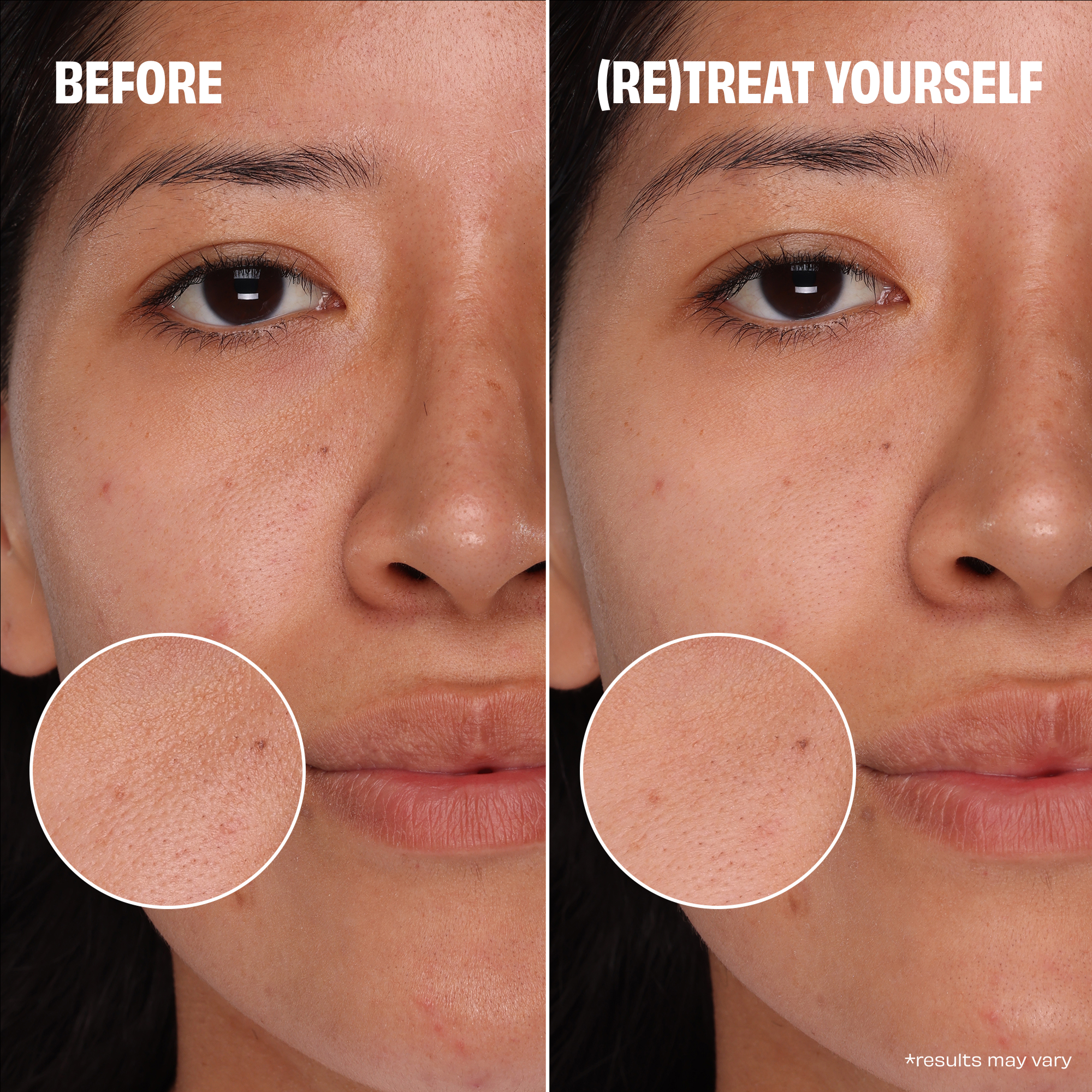 Benefit Cosmetics POREfessional Pore Care: Unclog Pores Set