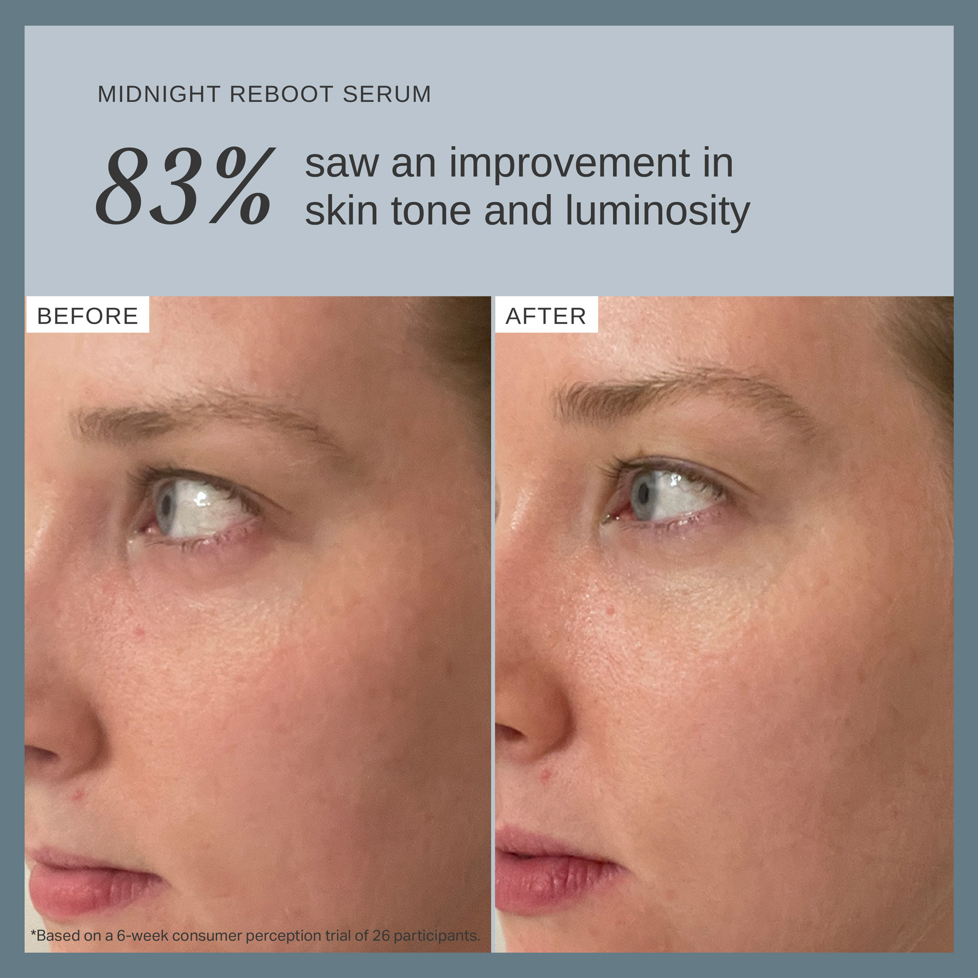 Alpha-H Midnight Reboot Serum with 14% Glycolic Acid and 1% Granactive Retinoid 10mL