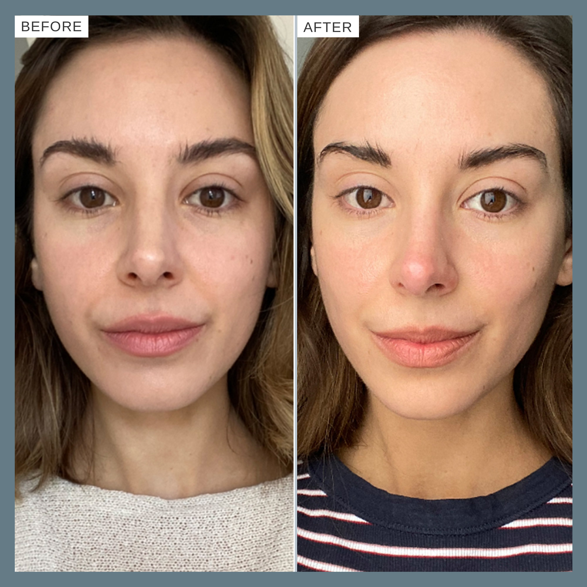 Alpha-H Vitamin C Serum with 10% Ethyl Ascorbic Acid 10ml