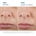 SkinCeuticals Hyaluronic Acid Serum HA Intensifier Multi-Glycan 30ml