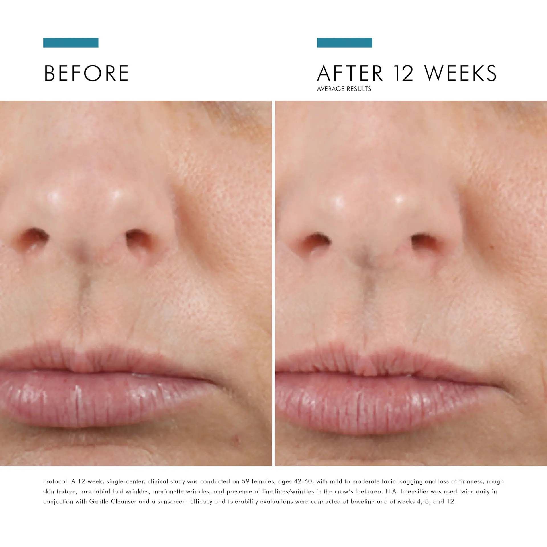 SkinCeuticals Hyaluronic Acid Serum HA Intensifier Multi-Glycan 30ml
