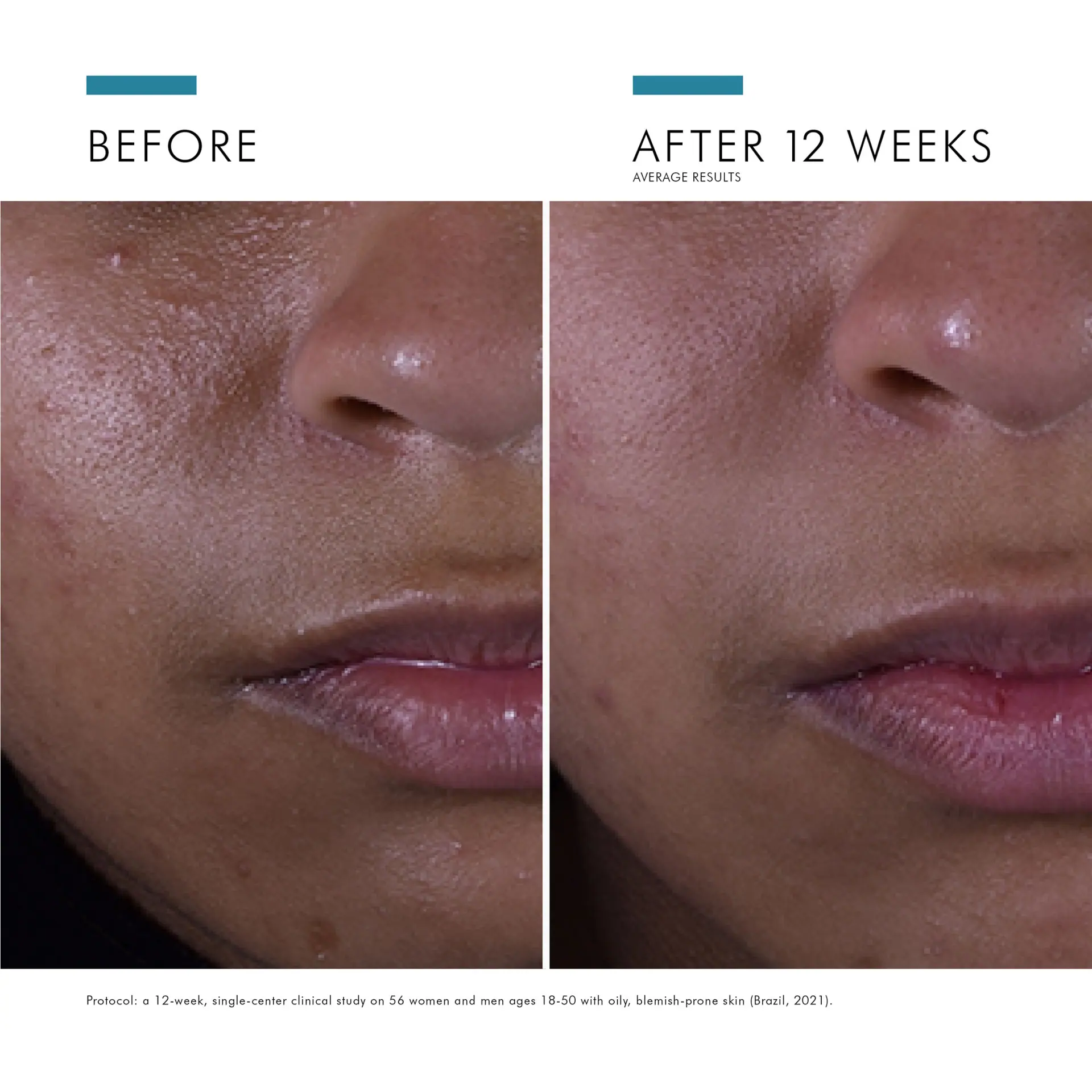 SkinCeuticals Silymarin CF 30ml