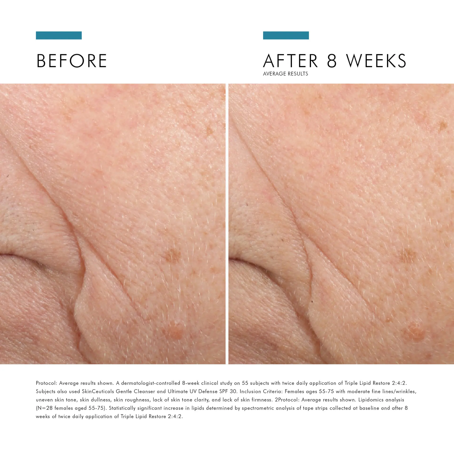 SkinCeuticals Triple Lipid Restore 242 Anti-Ageing Moisturiser 48ml