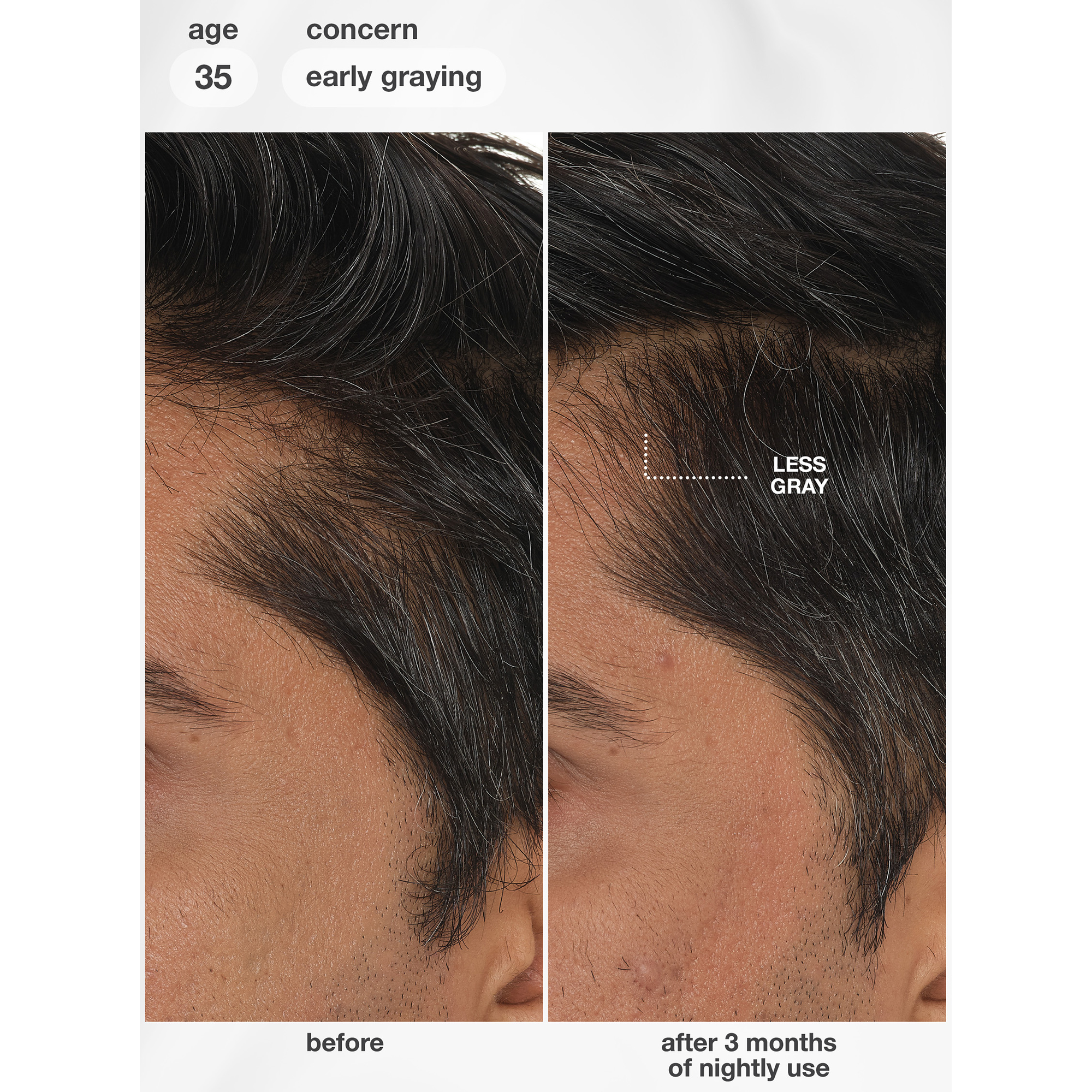 K18 Future IQ Biomimetic Hair Longevity Serum 90 mL