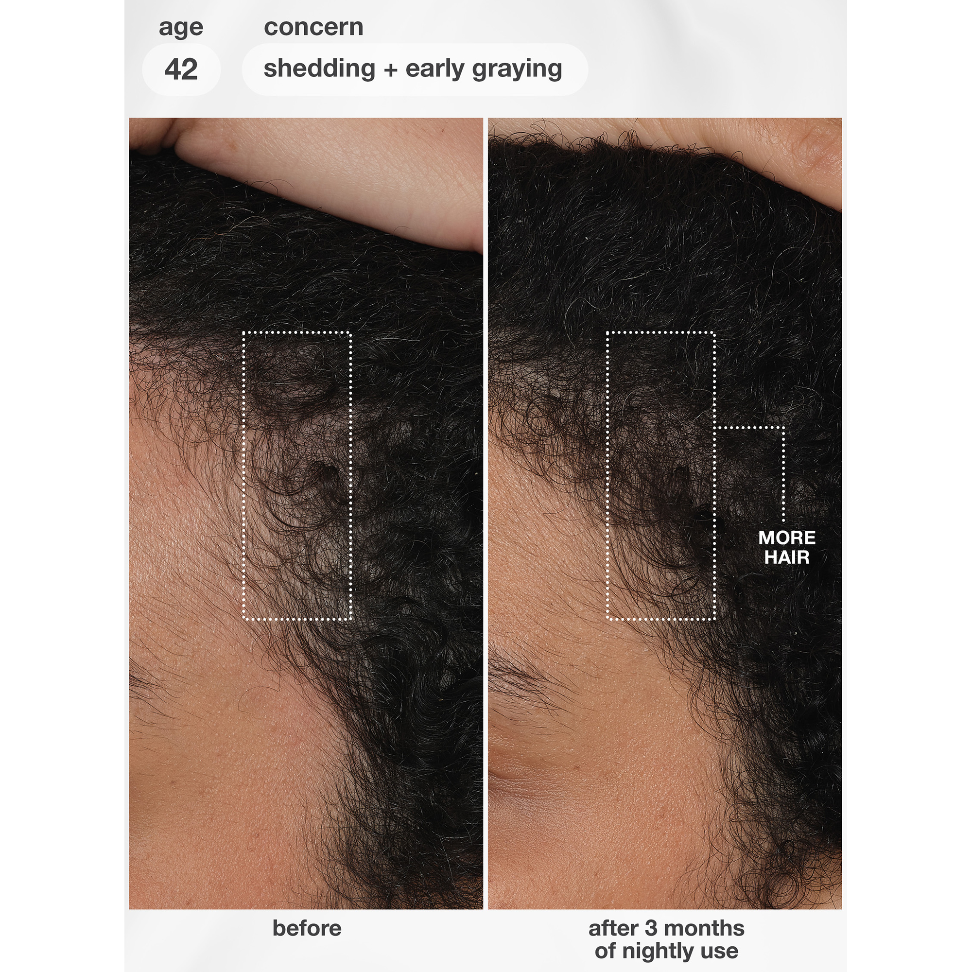 K18 Future IQ Biomimetic Hair Longevity Serum 90 mL