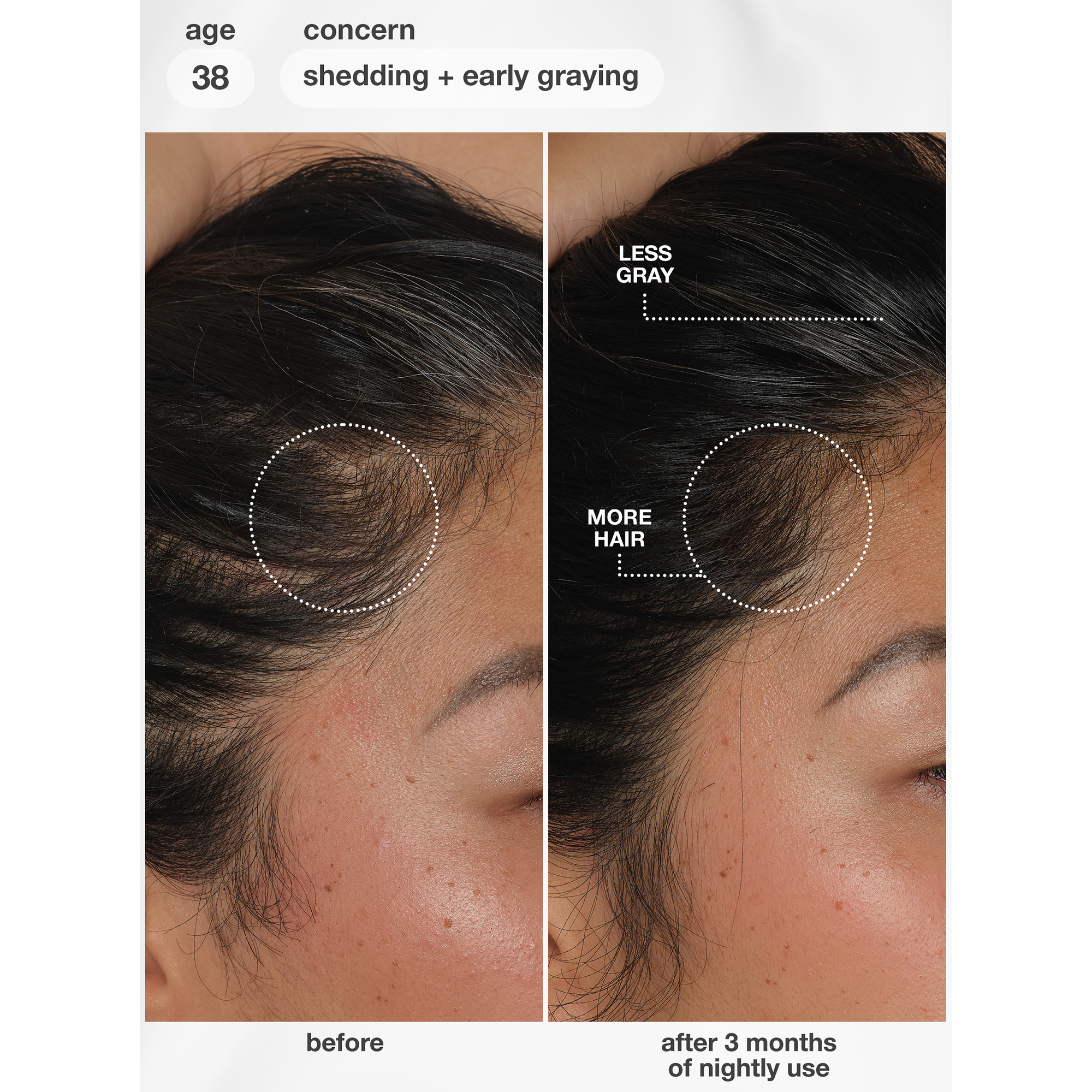 K18 Future IQ Biomimetic Hair Longevity Serum 90 mL