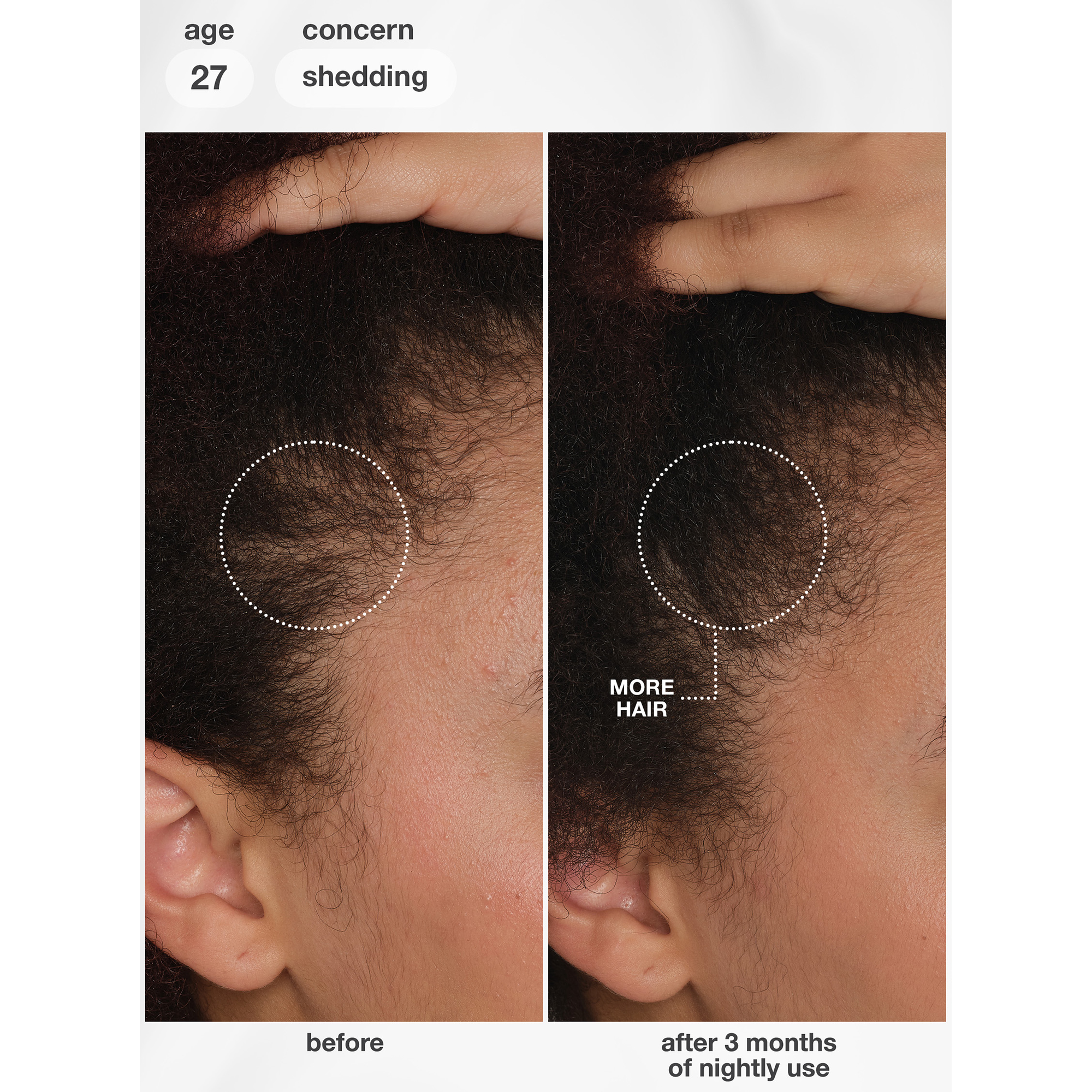 K18 Future IQ Biomimetic Hair Longevity Serum 90 mL