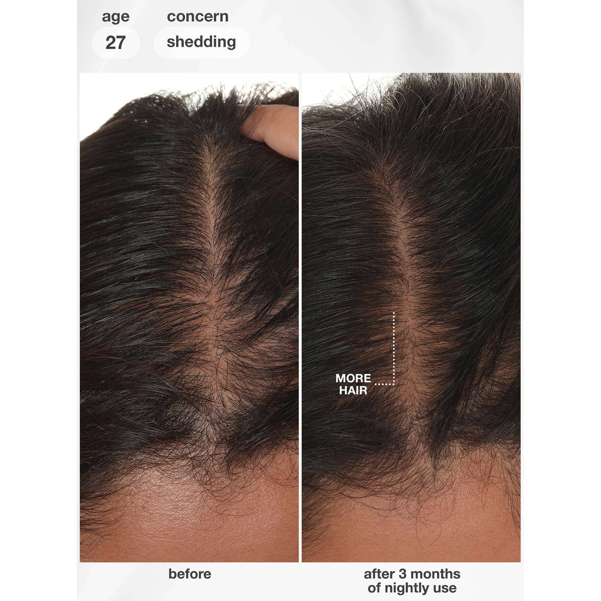 K18 Future IQ Biomimetic Hair Longevity Serum 90 mL