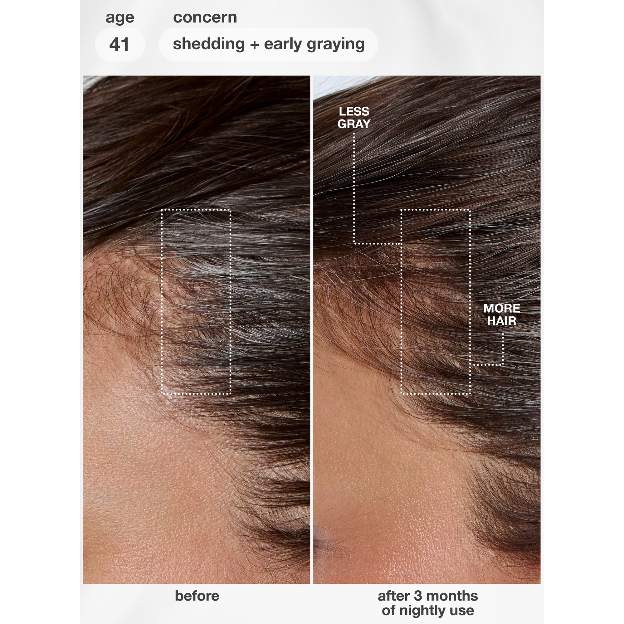 K18 Future IQ Biomimetic Hair Longevity Serum 90 mL