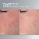 Dermalogica Daily Microfoliant