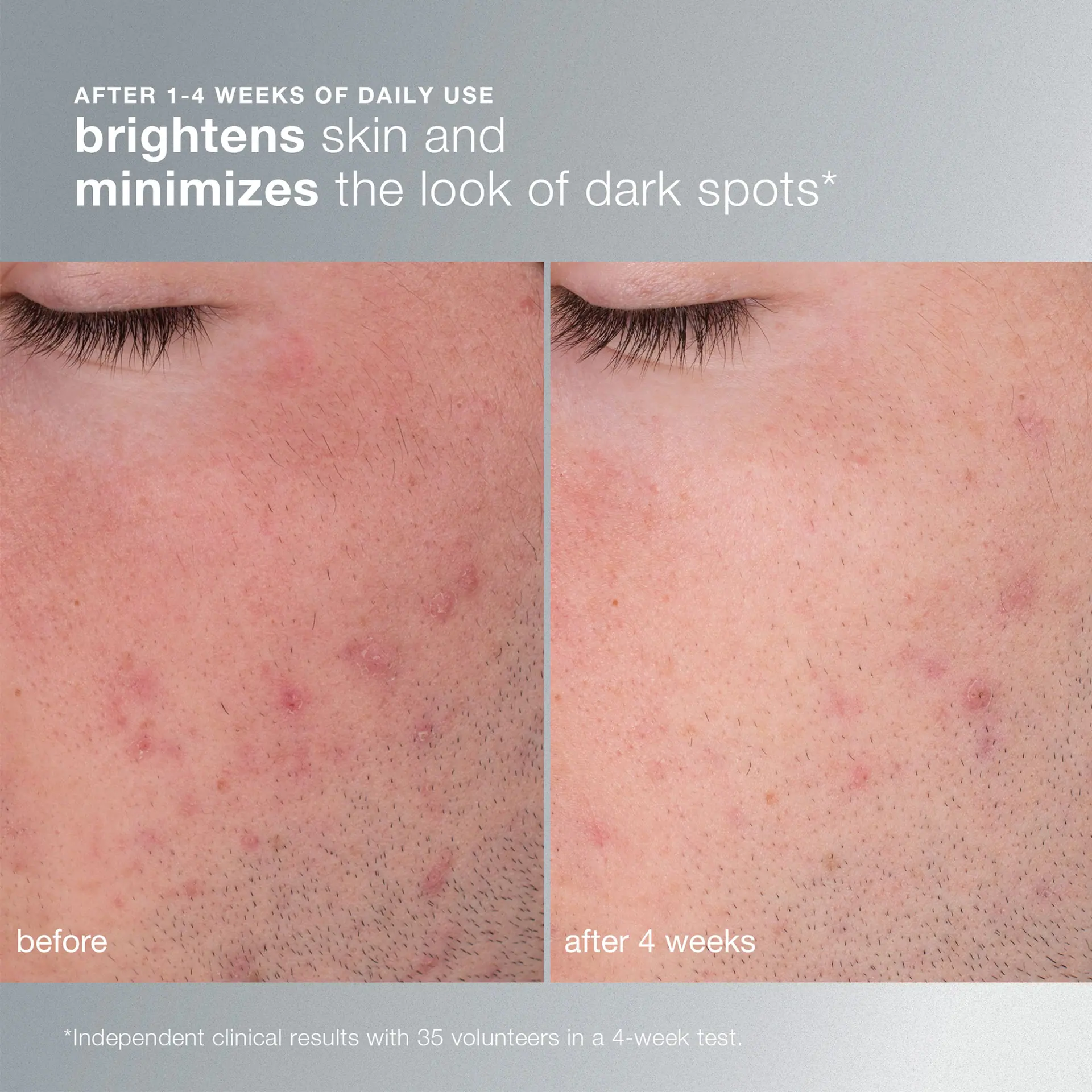 Dermalogica Daily Microfoliant