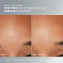 Dermalogica Daily Microfoliant