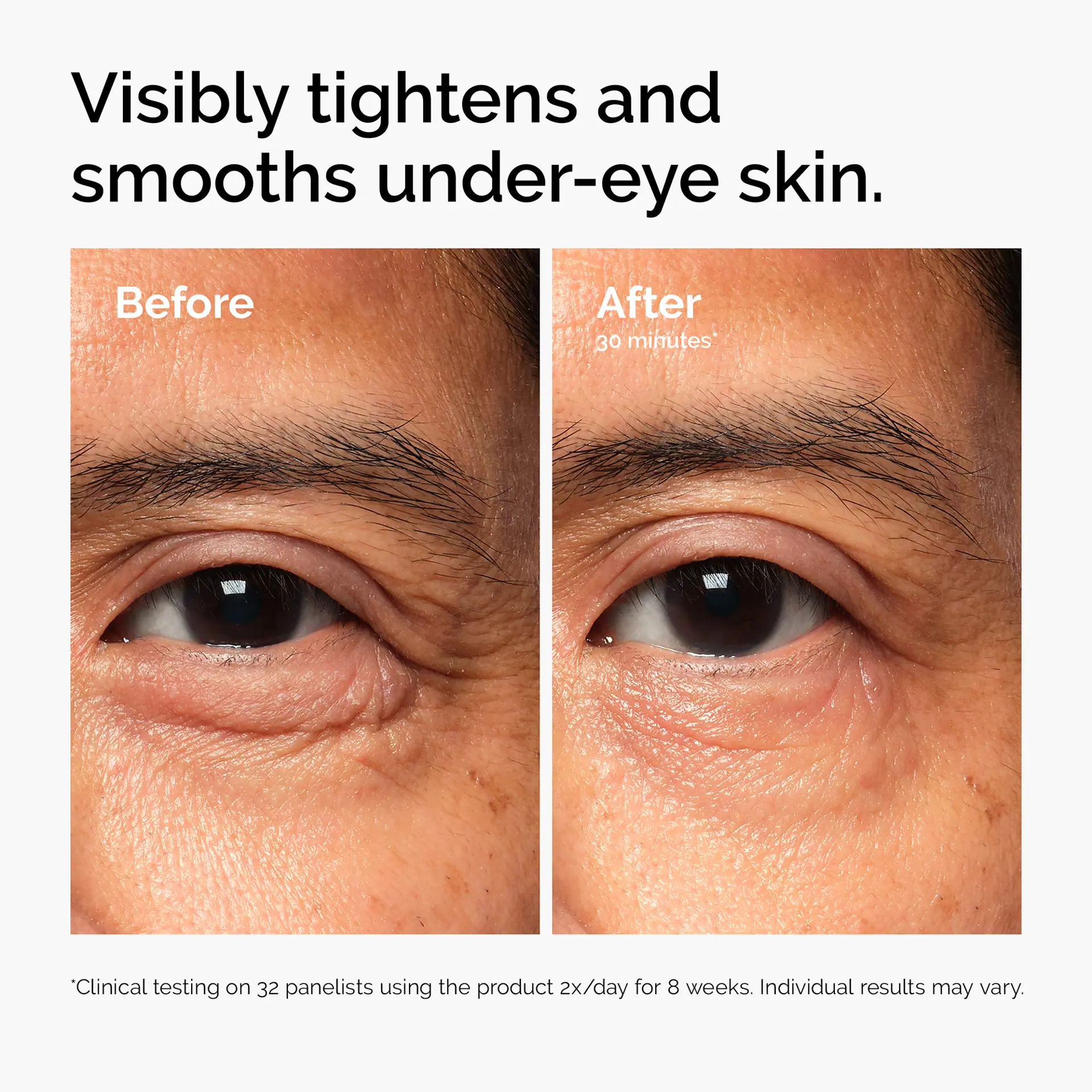 The Ordinary Lacto-PDRN* 4% + B9 Eye Cream