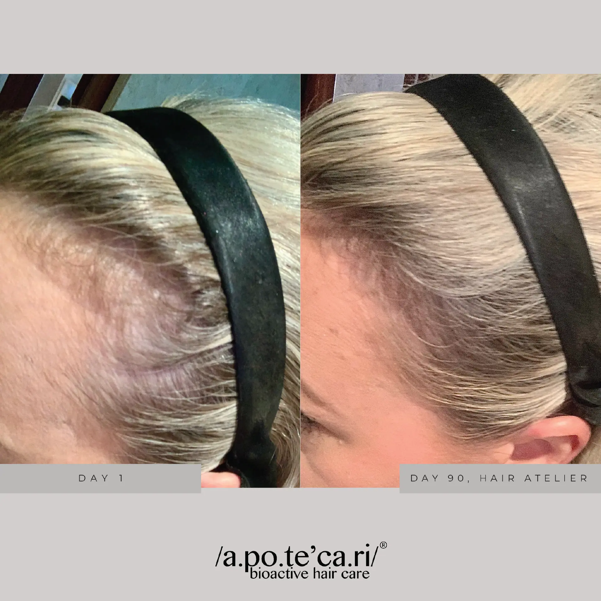 Apotecari Hair Atelier 30 Day Replenish Pack
