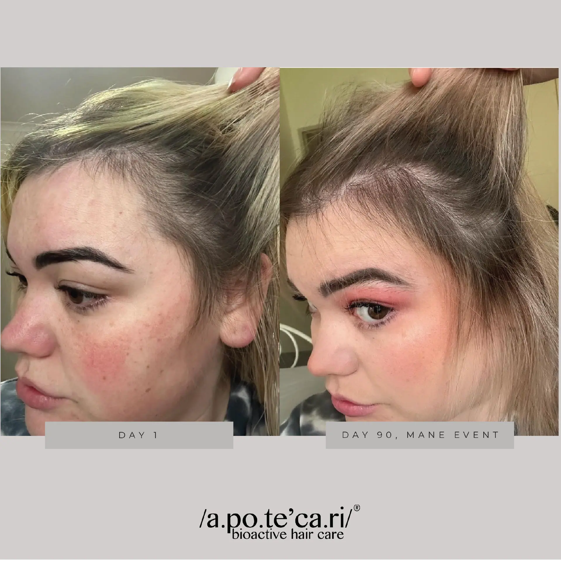 Apotecari Mane Event 90 Day Kit