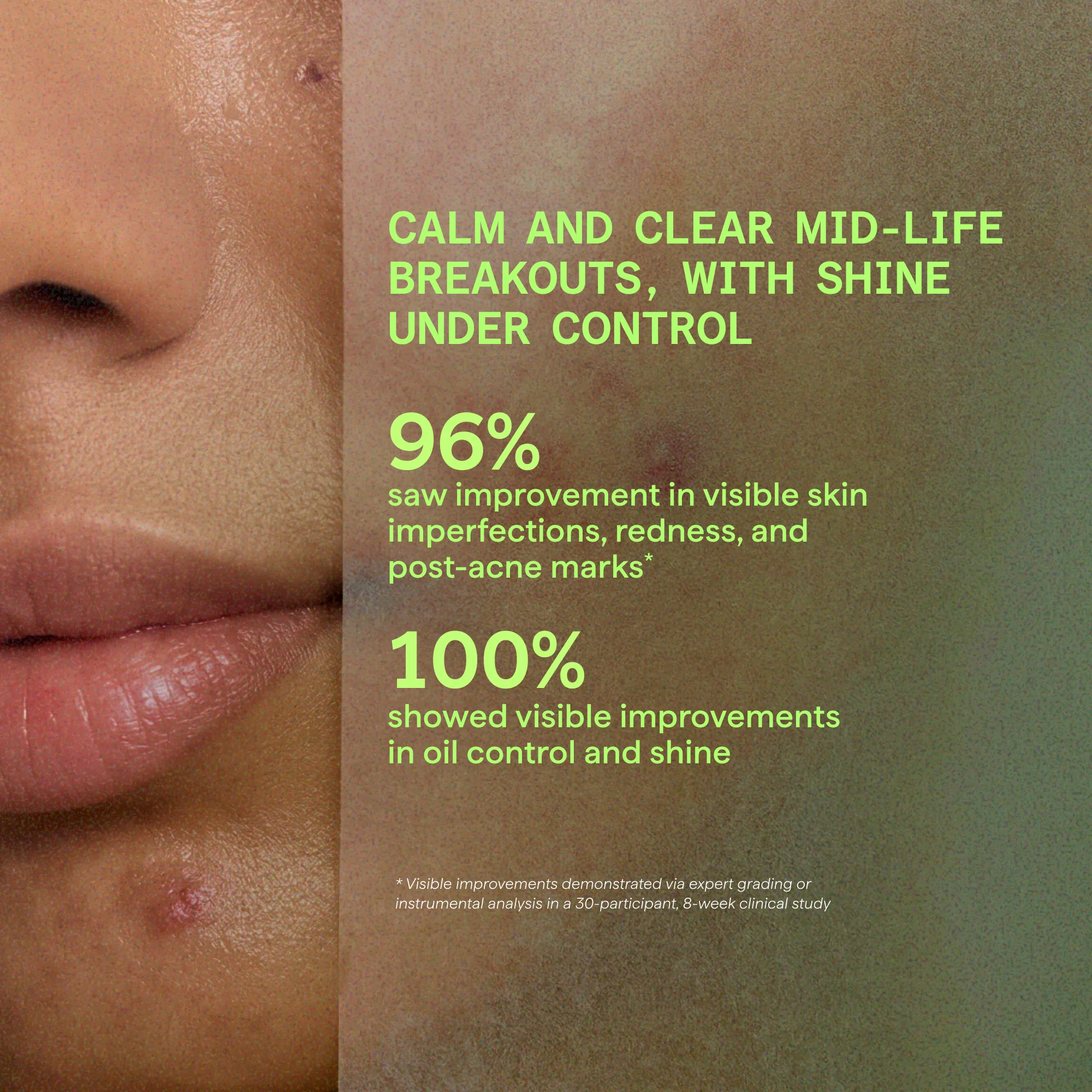 Murad Biome-Balancing Calm & Recover Cream