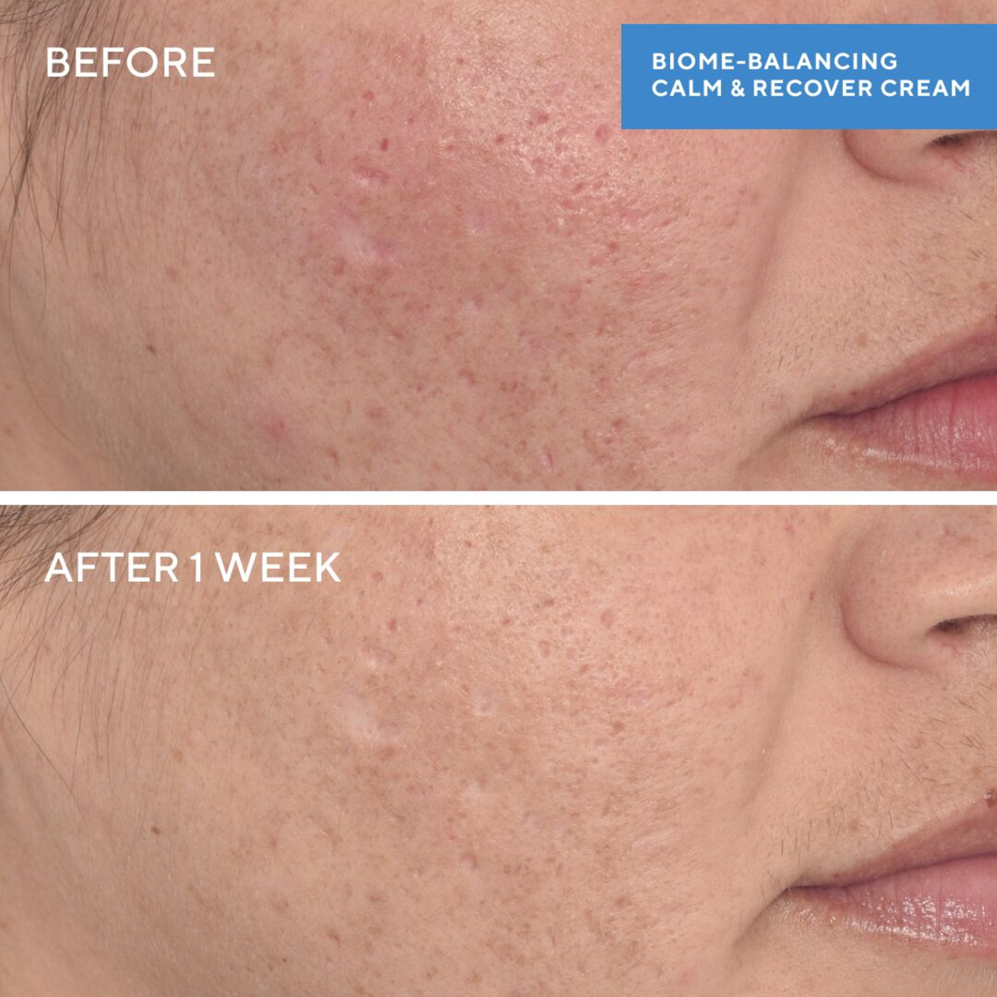 Murad Biome-Balancing Calm & Recover Cream
