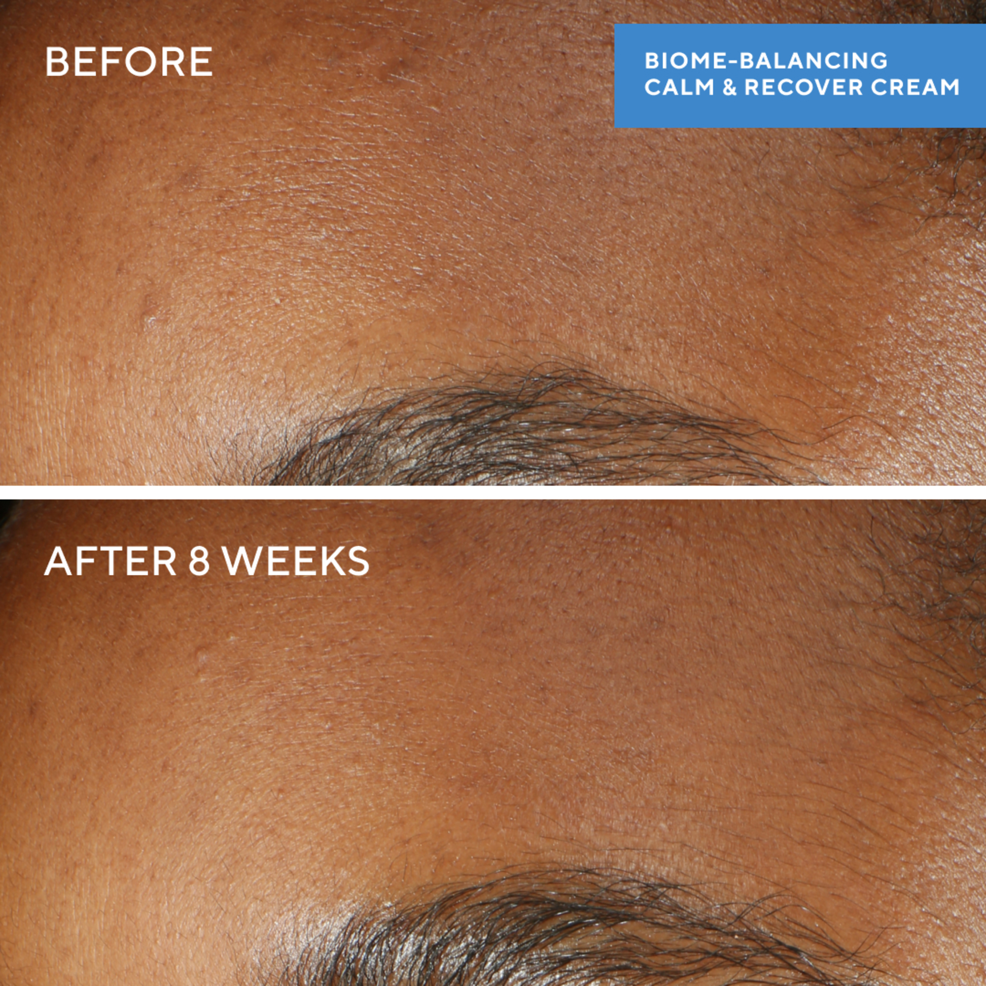 Murad Biome-Balancing Calm & Recover Cream