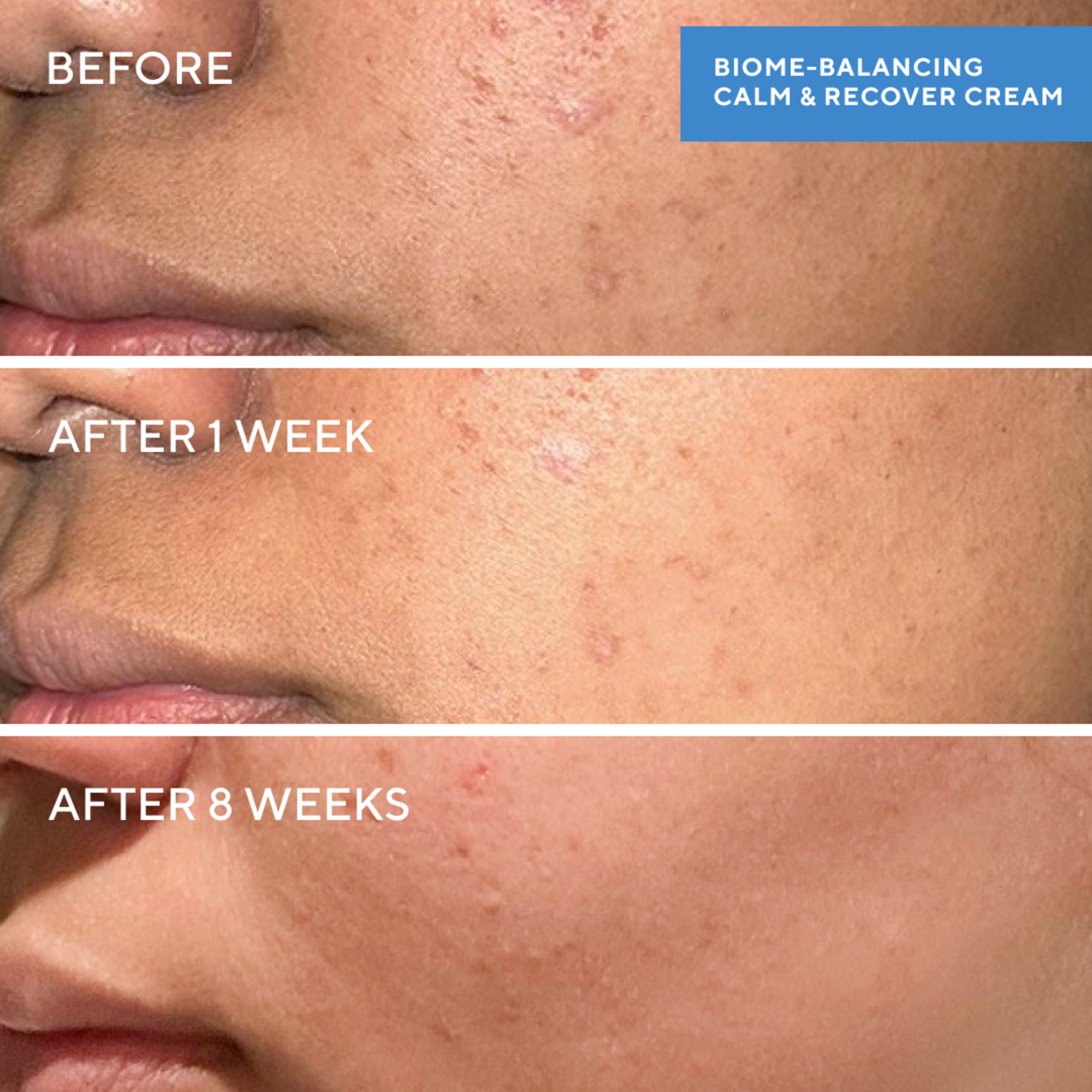 Murad Biome-Balancing Calm & Recover Cream