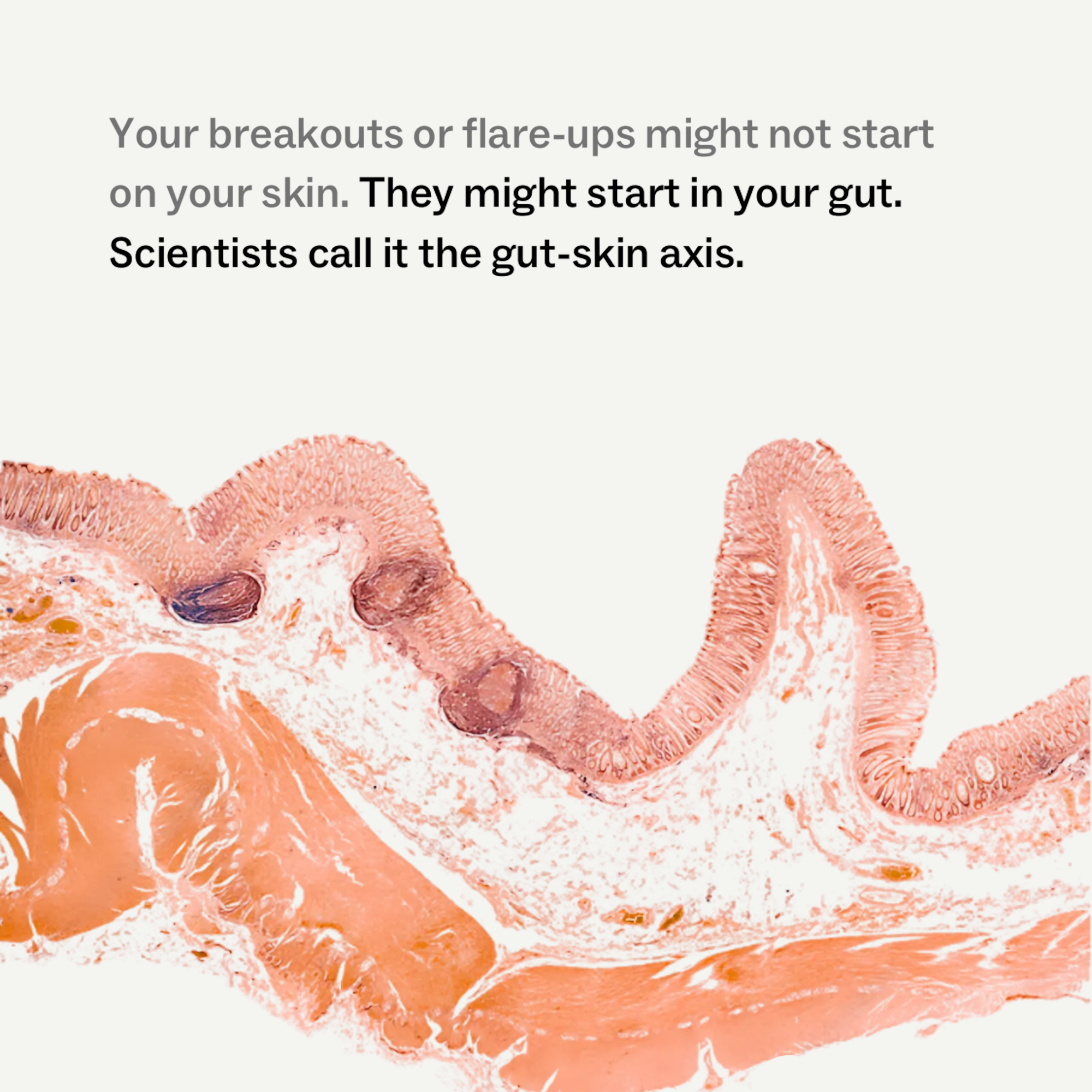 My Way Up Skin + Gut